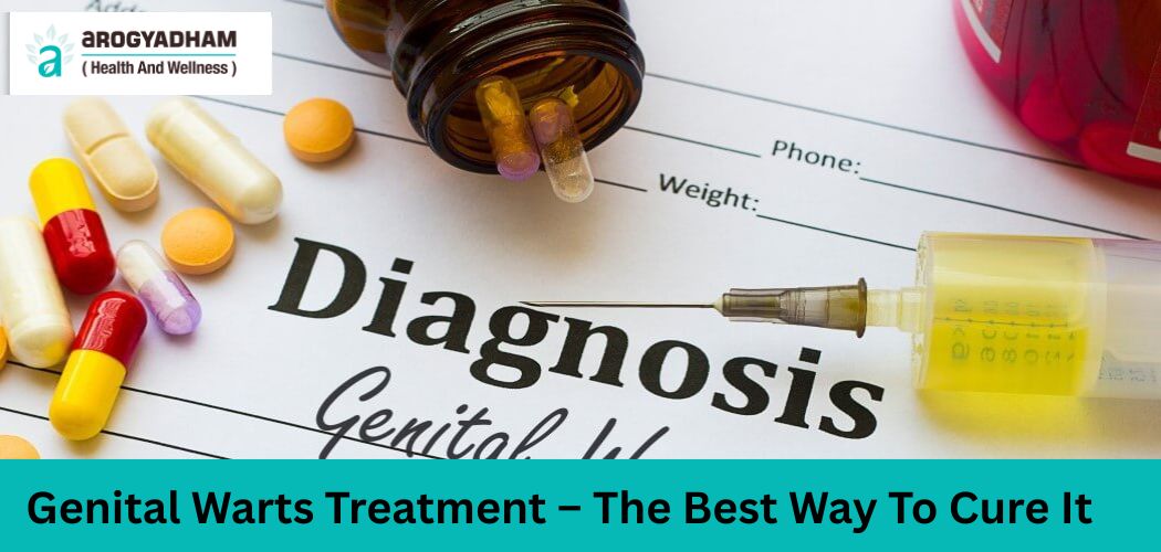 Genital Warts Treatment – The Best Way To Cure It Genital Warts Treatment – The Best Way To Cure It