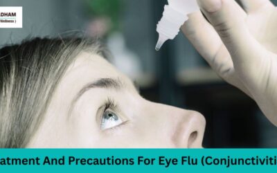 Guide On Treatment And Precautions For Eye Flu (Conjunctivitis)