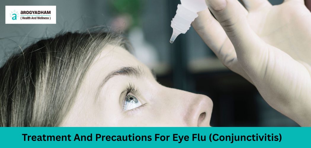 Guide On Treatment And Precautions For Eye Flu (Conjunctivitis)