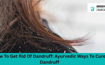 How To Get Rid Of Dandruff: Ayurvedic Ways To Cure Dandruff