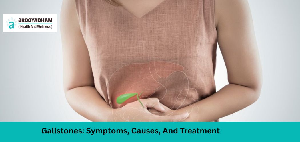 Gallstones Symptoms, Causes, And Treatment Gallstones Symptoms, Causes, And Treatment