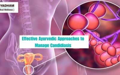 Effective Ayurvedic Approaches to Manage Candidiasis