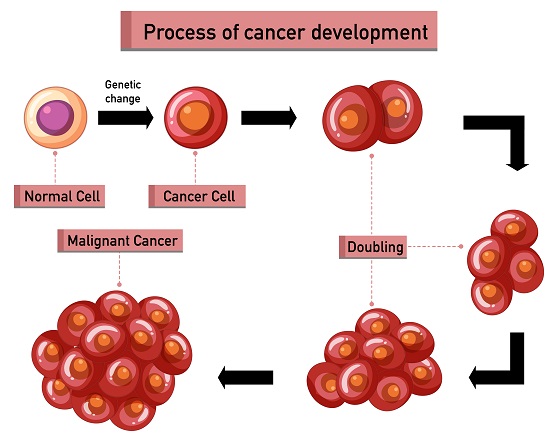 Process of Cancer Development Process of Cancer Development