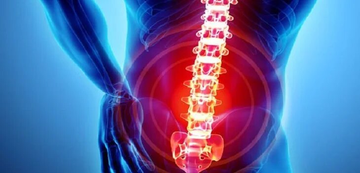 Ayurvedic Treatment for Back Pain in Accra
