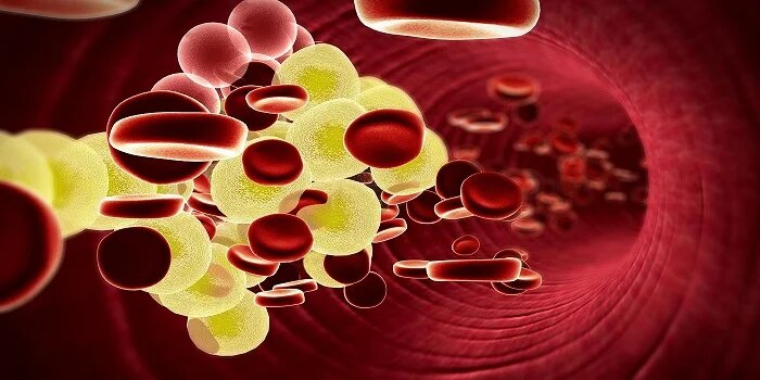 Ayurvedic Treatment for High Cholesterol in Kanpur