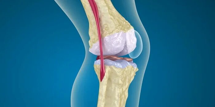 Ayurvedic Treatment for Osteoporosis in Singapore