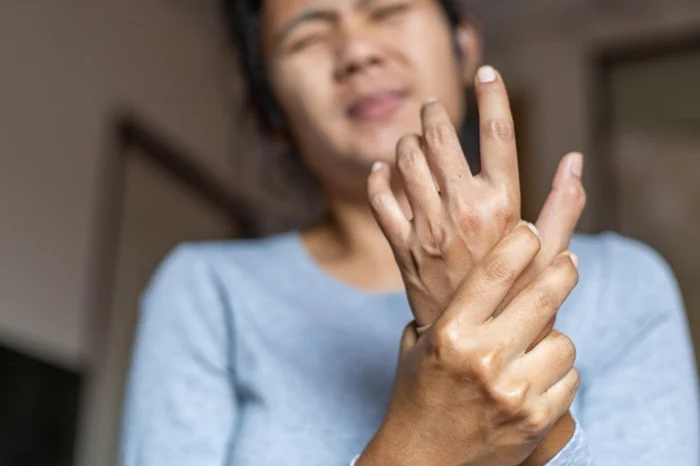 Rheumatoid Arthritis