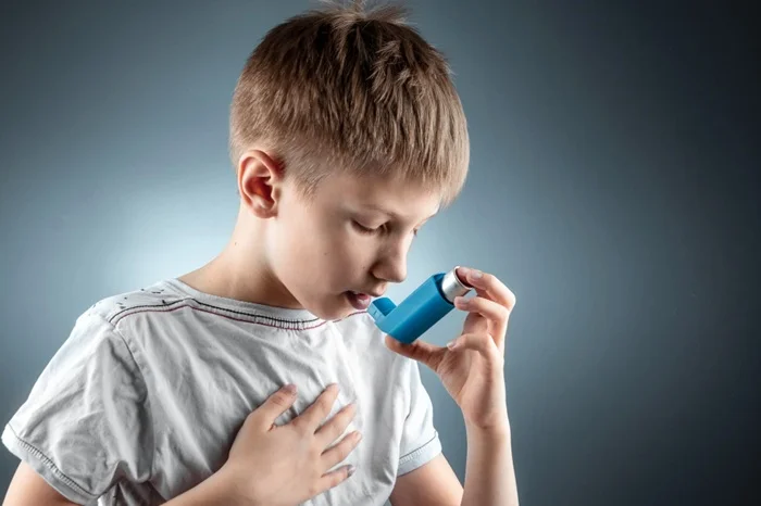Allergic Asthma (Extrinsic Asthma)