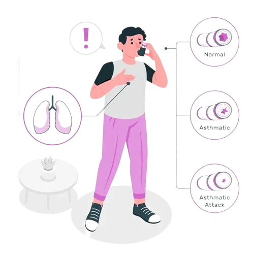 What is Asthma?