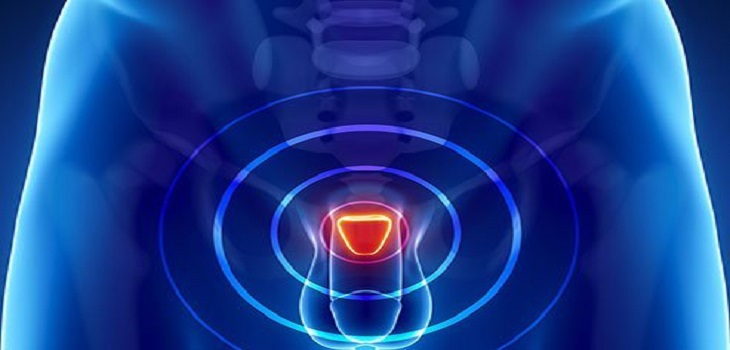 Ayurvedic Treatment for Enlarged Prostate in Bhatpara