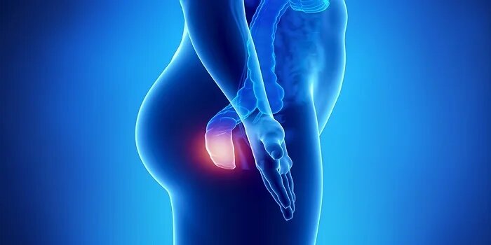 Ayurvedic Treatment for Piles in Bhatpara