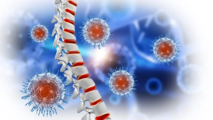 Rare Causes Of Back Pain