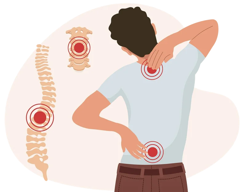 What is Back Pain?