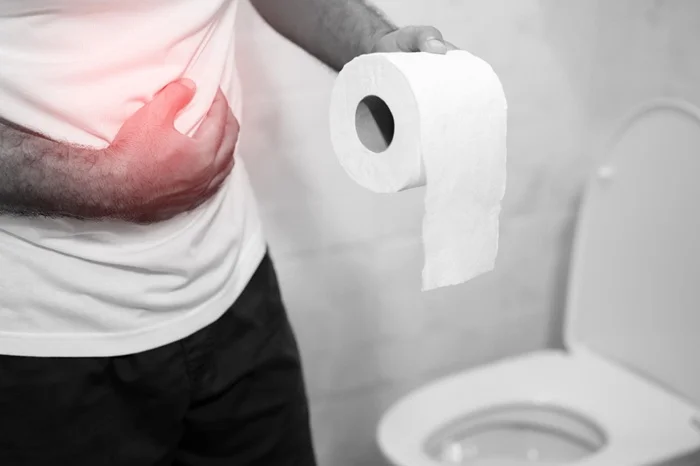 Constipation Constipation