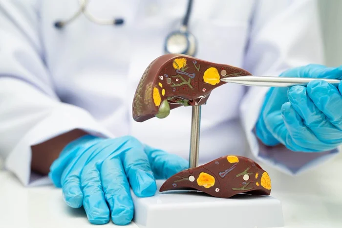 Non-Alcoholic Fatty Liver Disease
