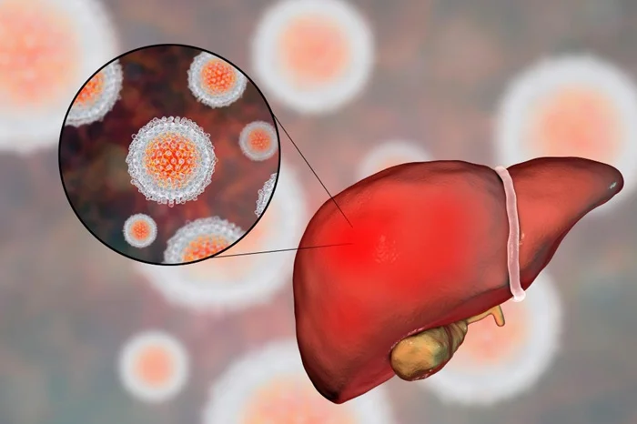 Viral Hepatitis