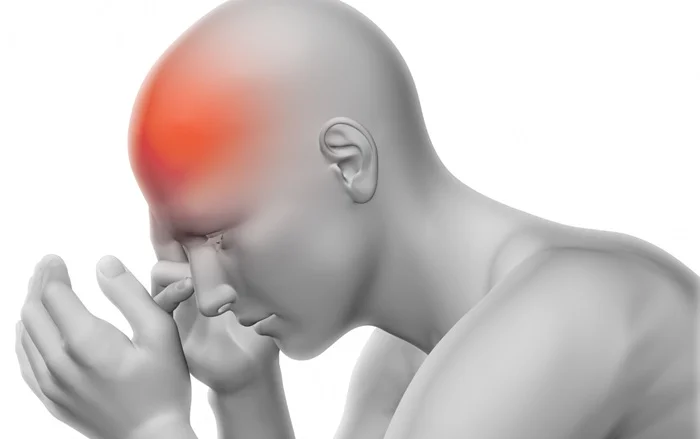 Migraine without aura (common Migraine)