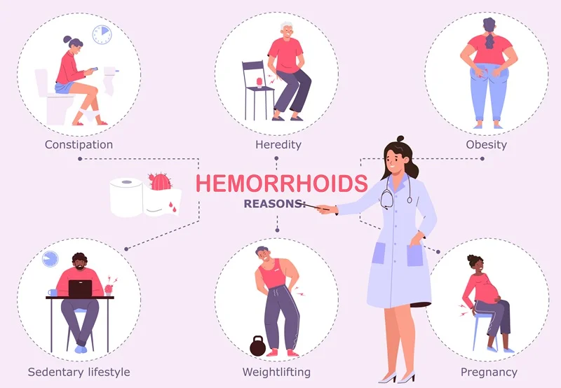 What is haemorrhoids/piles?